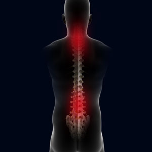 Non-Operative Treatments for Lower Back Injuries