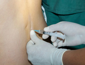 In-Office Lumbar Injections
