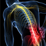 Non-Operative Treatments for Lower Back Injuries