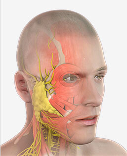Botox for Migraine Headaches 